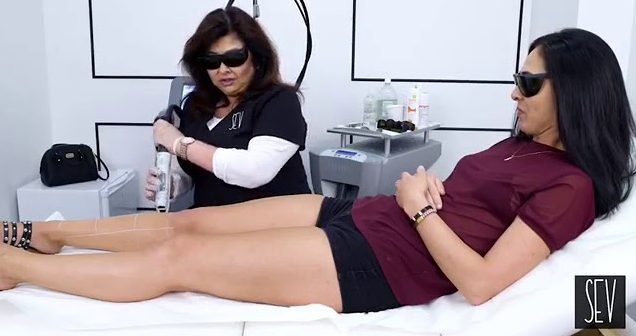 Legs Laser Hair Removal
