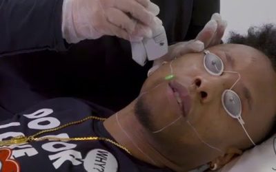 Laser Hair Removal for Men