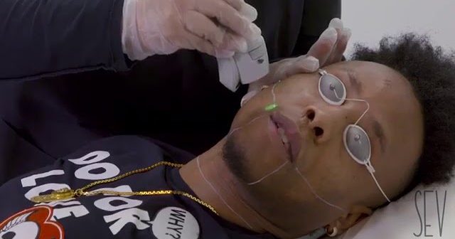 Laser Hair Removal for Men