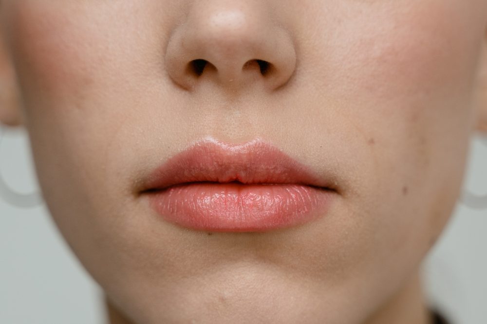 How Long Do Lip Fillers Last ?