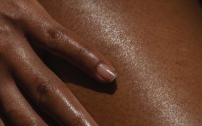 Laser Hair Removal on Broken Skin